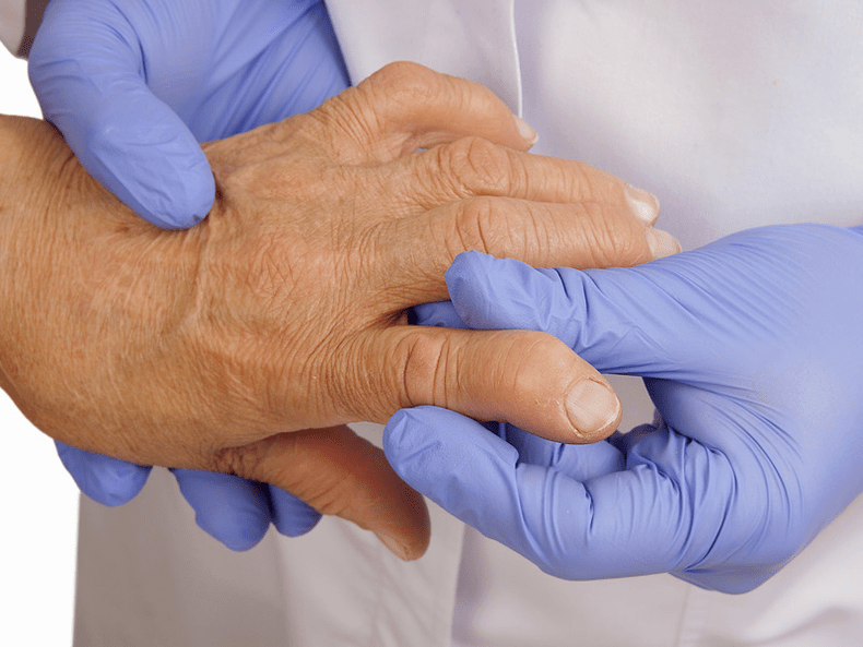 el médico examina la mano para detectar dolor en las articulaciones de los dedos